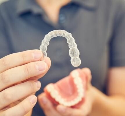 Aligner-Schiene zur kieferorthopädischen Zahnkorrektur